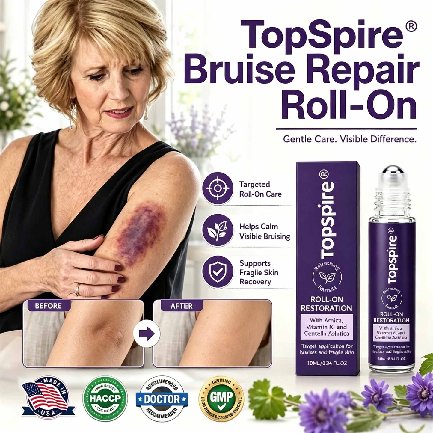 TopSpire®  Bruise Repair Roll-On