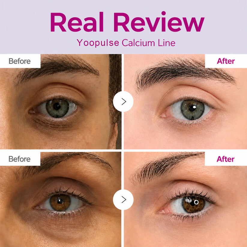 Cossetcare real review before and after