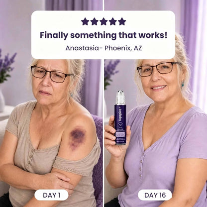 TopSpire®  Bruise Repair Roll-On