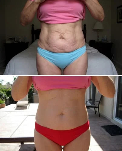 Customer body oil before and after results