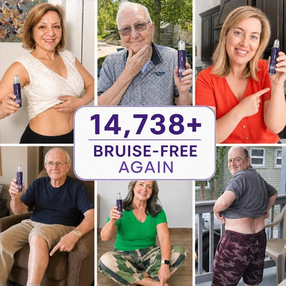 TopSpire®  Bruise Repair Roll-On